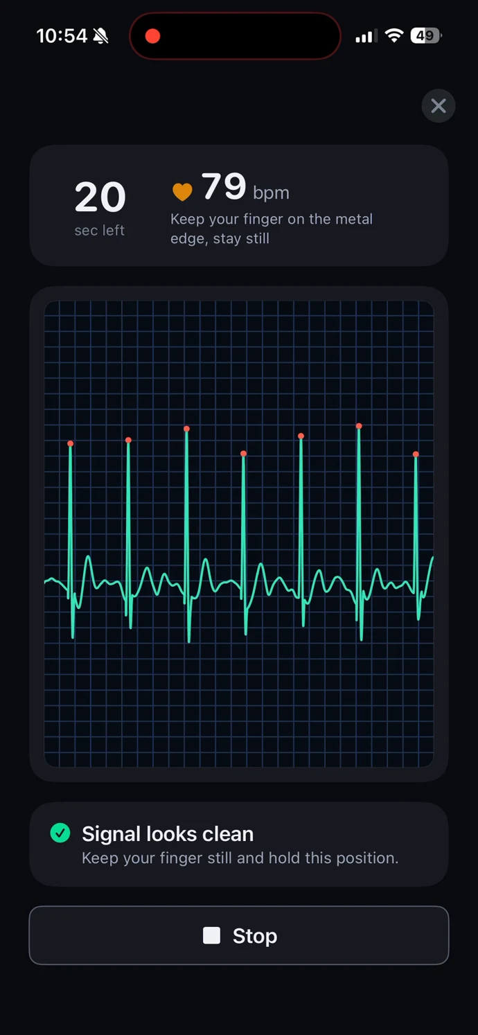 CarePlix CardiacPro live ECG screen